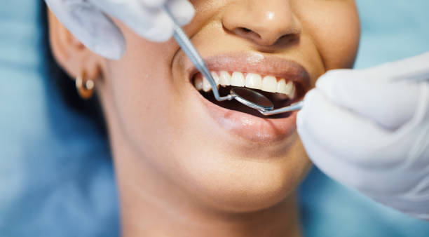 Best Emergency Dentist for Special Needs Patients in Milledgeville, GA